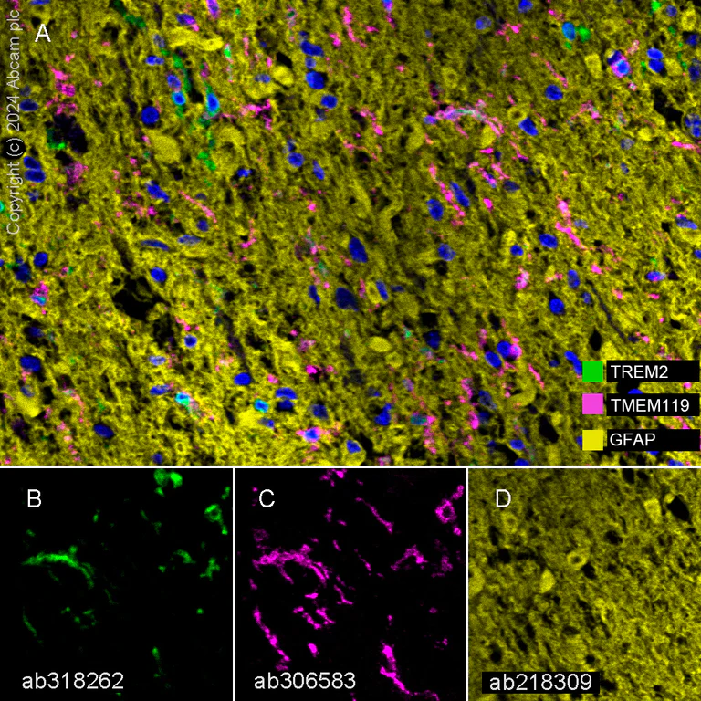 Multiplex immunohistochemistry - Anti-TREM2 antibody [EPR26209-22] - BSA and Azide free (AB318263)