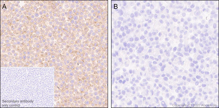 Immunohistochemistry (Formalin/PFA-fixed paraffin-embedded sections) - Anti-TREM2 antibody [EPR26210-1] (AB305103)