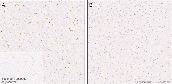 Immunohistochemistry (Formalin/PFA-fixed paraffin-embedded sections) - Anti-TREM2 antibody [EPR26210-1] (AB305103), expandable thumbnail