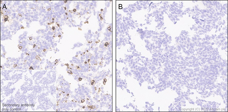 Immunohistochemistry (Formalin/PFA-fixed paraffin-embedded sections) - Anti-TREM2 antibody [EPR26210-1] (AB305103), expandable thumbnail