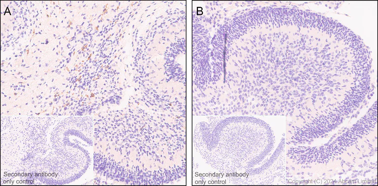 Immunohistochemistry (Formalin/PFA-fixed paraffin-embedded sections) - Anti-TREM2 antibody [EPR26210-1] (AB305103)