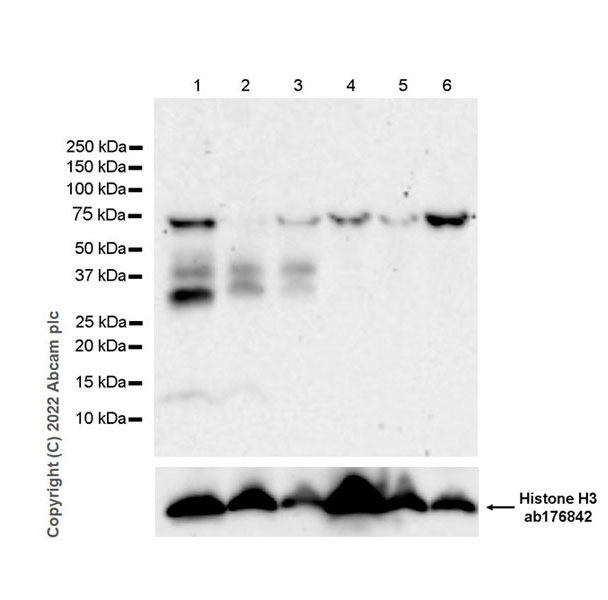 Western blot - Anti-TREM2 antibody [EPR26210-1] (AB305103), expandable thumbnail