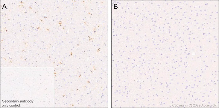 Immunohistochemistry (Formalin/PFA-fixed paraffin-embedded sections) - Anti-TREM2 antibody [EPR26210-1] - BSA and Azide free (AB305072)