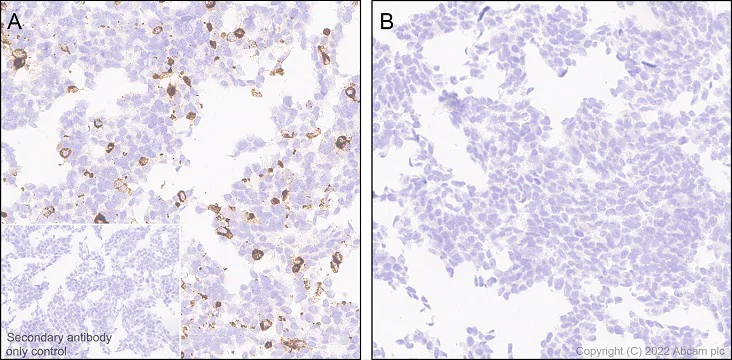 Immunohistochemistry (Formalin/PFA-fixed paraffin-embedded sections) - Anti-TREM2 antibody [EPR26210-1] - BSA and Azide free (AB305072)