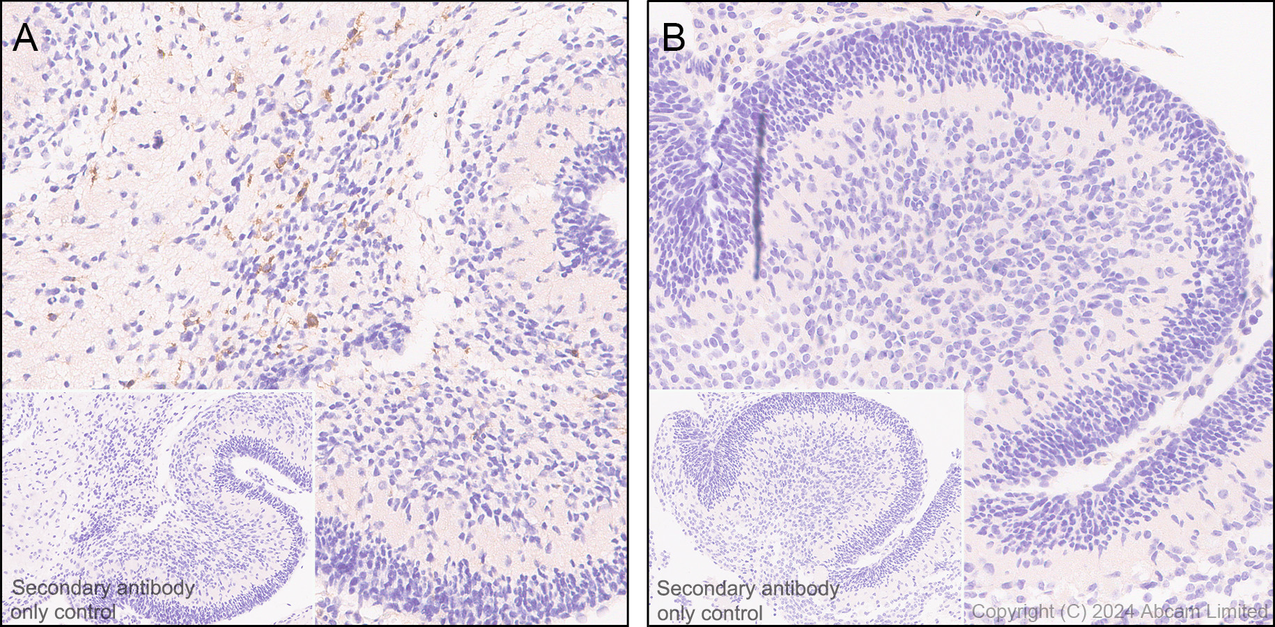 Immunohistochemistry (Formalin/PFA-fixed paraffin-embedded sections) - Anti-TREM2 antibody [EPR26210-1] - BSA and Azide free (AB305072), expandable thumbnail