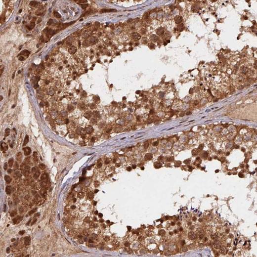 Immunohistochemistry (Formalin/PFA-fixed paraffin-embedded sections) - Anti-TREML4 antibody (AB204798)