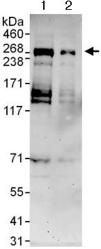 Western blot - Anti-Treslin antibody (AB124268), expandable thumbnail