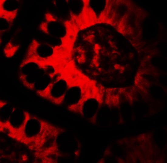 Immunohistochemistry (Formalin/PFA-fixed paraffin-embedded sections) - Anti-Treslin antibody - C-terminal (AB191850)