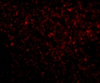 Immunocytochemistry/ Immunofluorescence - Anti-TREX1 antibody (AB83890)