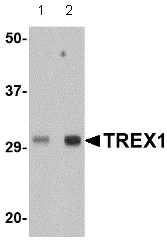 Western blot - Anti-TREX1 antibody (AB83890)