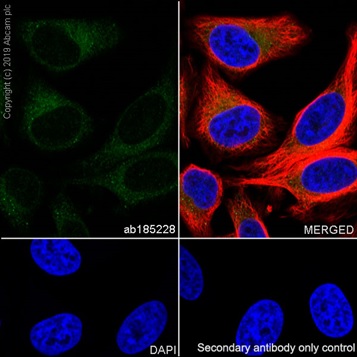 Anti-TREX1 antibody [EPR14985] (ab185228) | Abcam