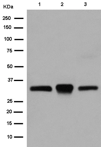 YF様 Anti-TREX1 antibody [EPR14985] (ab185228) | Abcam