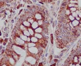 Immunohistochemistry (Formalin/PFA-fixed paraffin-embedded sections) - Anti-TREX1 antibody [EPR14985] - BSA and Azide free (AB236140)