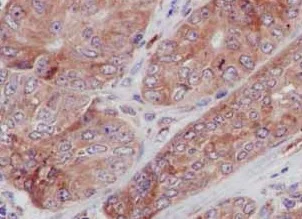 Immunohistochemistry (Formalin/PFA-fixed paraffin-embedded sections) - Anti-TREX1 antibody [EPR14985] - BSA and Azide free (AB236140)