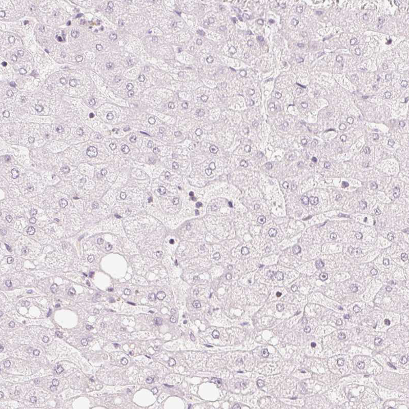 Immunohistochemistry (Formalin/PFA-fixed paraffin-embedded sections) - Anti-TREX2 antibody (AB185521)