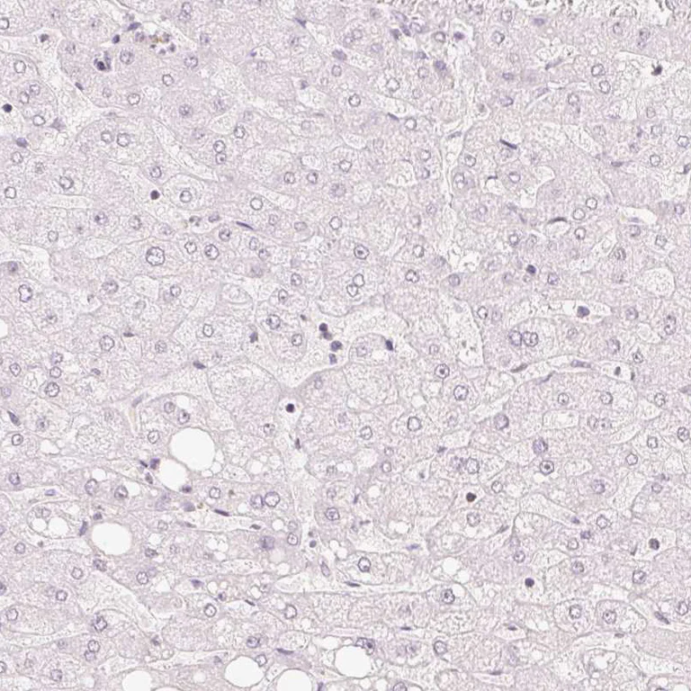 Immunohistochemistry (Formalin/PFA-fixed paraffin-embedded sections) - Anti-TREX2 antibody (AB185521)