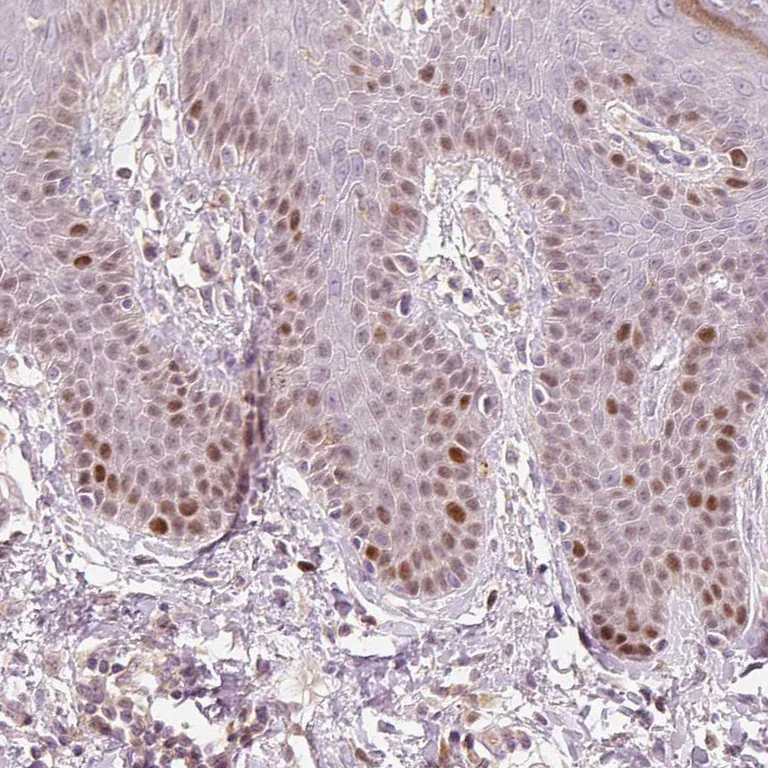 Immunohistochemistry (Formalin/PFA-fixed paraffin-embedded sections) - Anti-TREX2 antibody (AB185521)