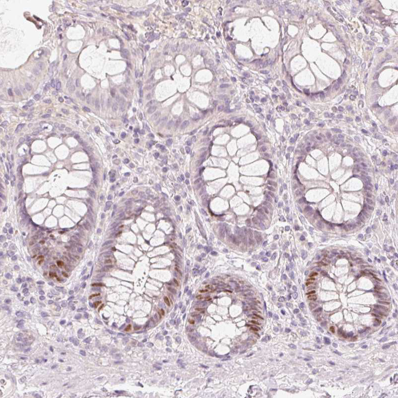 Immunohistochemistry (Formalin/PFA-fixed paraffin-embedded sections) - Anti-TREX2 antibody (AB185521)