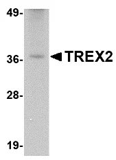 Western blot - Anti-TREX2 antibody (AB83893)