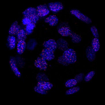 Immunocytochemistry/ Immunofluorescence - Anti-TRF1 antibody [572C] (AB192629)