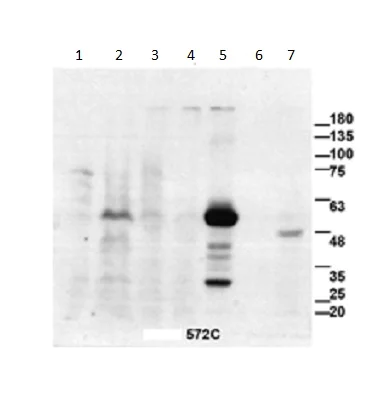 Western blot - Anti-TRF1 antibody [572C] (AB192629)