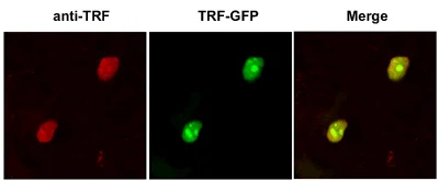 Immunocytochemistry - Anti-TRF1 antibody (AB1423)
