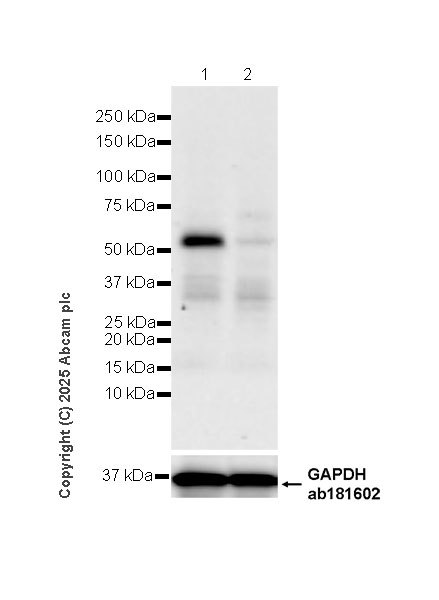 Western blot - Anti-TRF1 antibody [EPR28580-71] (AB323380), expandable thumbnail