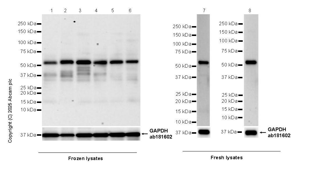 Western blot - Anti-TRF1 antibody [EPR28580-71] (AB323380), expandable thumbnail