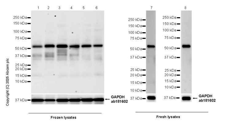 Western blot - Anti-TRF1 antibody [EPR28580-71] (AB323380)