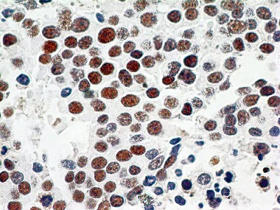 Immunohistochemistry (Formalin/PFA-fixed paraffin-embedded sections) - Anti-TRF2 antibody [4A794] (AB13579)