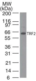 Western blot - Anti-TRF2 antibody [4A794] (AB13579)