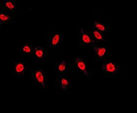 Immunocytochemistry/ Immunofluorescence - Anti-TRF2 antibody [EPR3517(2)] (AB108997)