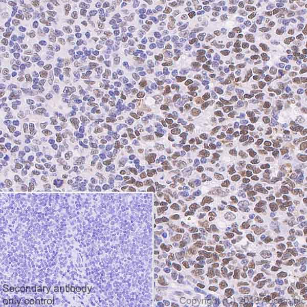 Immunohistochemistry (Formalin/PFA-fixed paraffin-embedded sections) - Anti-TRF2 antibody [EPR3517(2)] (AB108997), expandable thumbnail