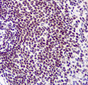 Immunohistochemistry (Formalin/PFA-fixed paraffin-embedded sections) - Anti-TRF2 antibody [EPR3517(2)] (ab108997), expandable thumbnail