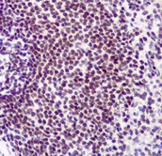 Immunohistochemistry (Formalin/PFA-fixed paraffin-embedded sections) - Anti-TRF2 antibody [EPR3517(2)] (AB108997)