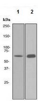 Western blot - Anti-TRF2 antibody [EPR3518(2)] (AB108932), expandable thumbnail