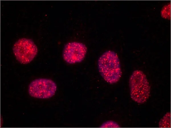 Immunocytochemistry/ Immunofluorescence - Anti-TRF2 + TRF1 antibody [TRF-78] (AB10579)