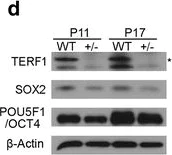 Western blot - Anti-TRF2 + TRF1 antibody [TRF-78] (AB10579)