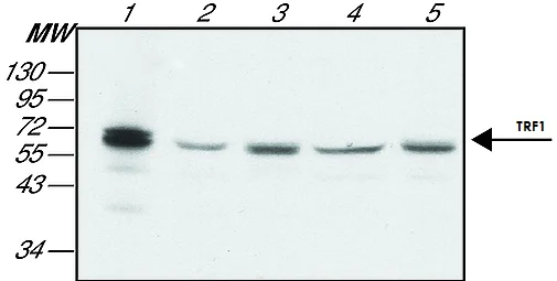 Western blot - Anti-TRF2 + TRF1 antibody [TRF-78] (AB10579)