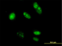 Immunocytochemistry/ Immunofluorescence - Anti-TRFP/MED20 antibody (AB67800)