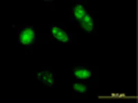 Immunocytochemistry/ Immunofluorescence - Anti-TRFP/MED20 antibody (AB67800)