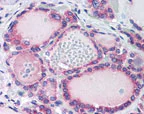 Immunohistochemistry (Formalin/PFA-fixed paraffin-embedded sections) - Anti-TRH-R antibody (AB72179)
