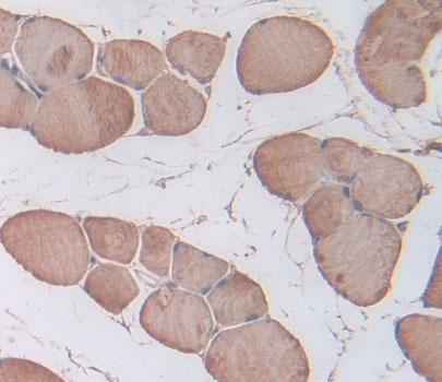 Immunohistochemistry (Formalin/PFA-fixed paraffin-embedded sections) - Anti-Triadin antibody (AB231058), expandable thumbnail