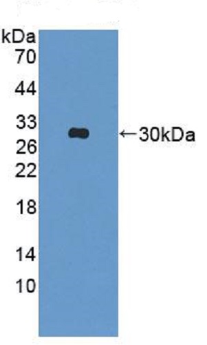 Western blot - Anti-Triadin antibody (AB231058), expandable thumbnail