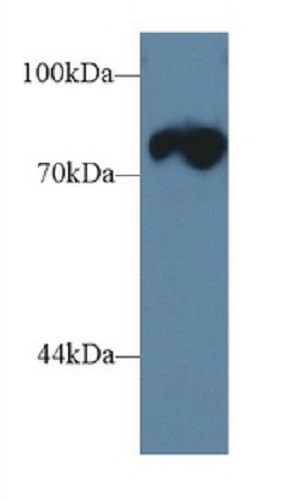 Western blot - Anti-Triadin antibody (AB231058), expandable thumbnail
