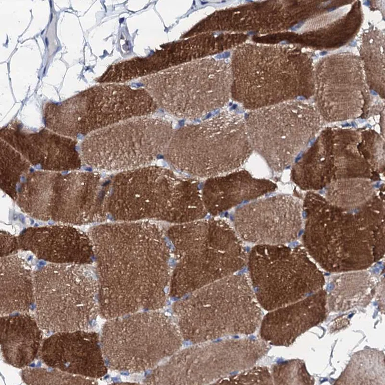 Immunohistochemistry (Formalin/PFA-fixed paraffin-embedded sections) - Anti-Triadin antibody (AB247008)