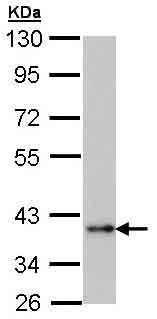 Western blot - Anti-TRIB1 antibody (AB137717), expandable thumbnail