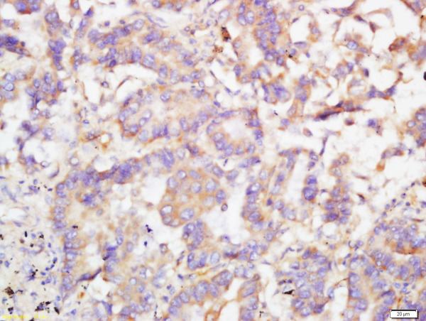 Immunohistochemistry (Formalin/PFA-fixed paraffin-embedded sections) - Anti-TRIB2 antibody (AB204119), expandable thumbnail
