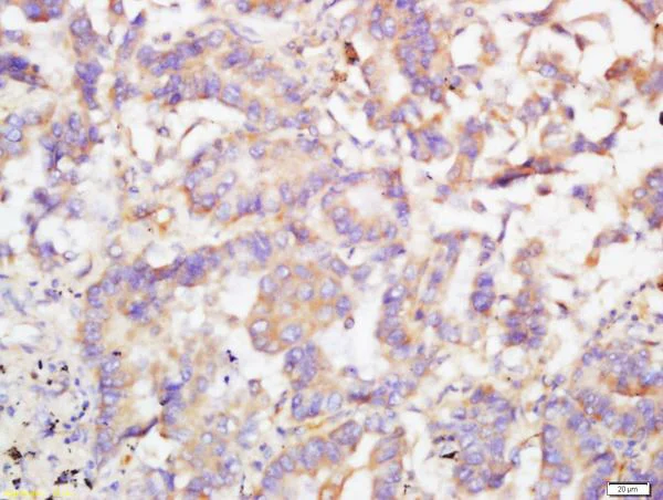 Immunohistochemistry (Formalin/PFA-fixed paraffin-embedded sections) - Anti-TRIB2 antibody (AB204119)