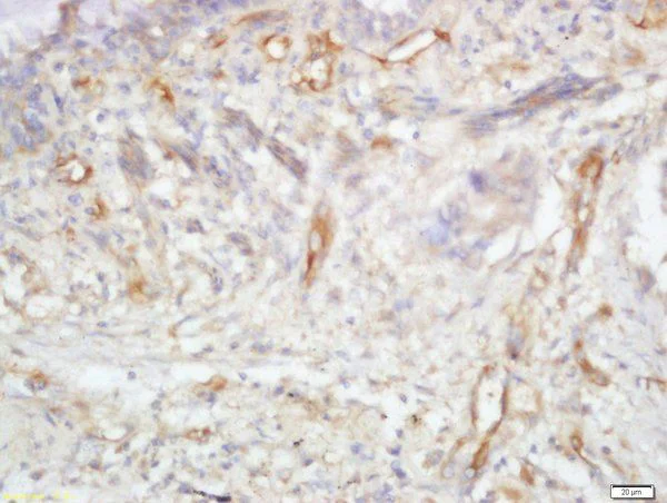 Immunohistochemistry (Formalin/PFA-fixed paraffin-embedded sections) - Anti-TRIB2 antibody (AB204119)